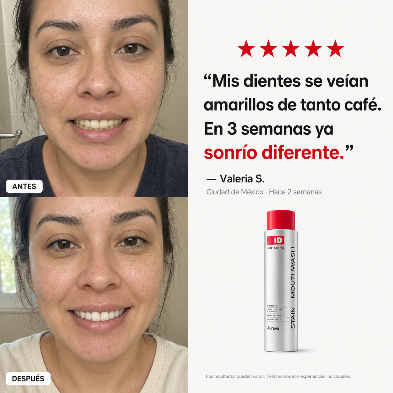 Aureva Hismile Tu Aliento Bajo Control